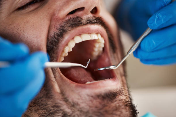 Best Emergency Dental Care for Broken or Chipped Teeth in Lithonia, GA