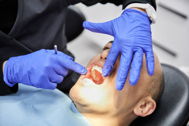 Best Emergency Treatment for Dental Infections or Abscesses in Lithonia, GA